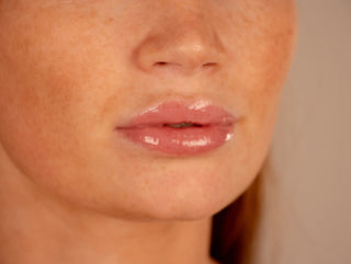 Melon Crush Phone Case